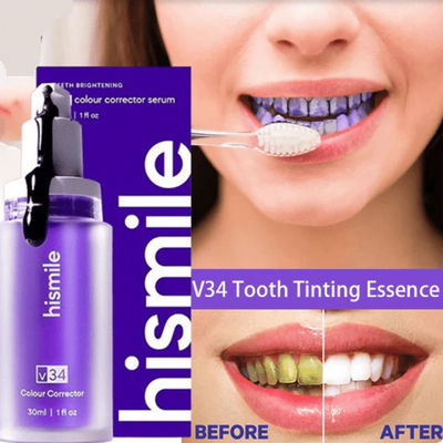 Hismile - Teeth Brightening Serum